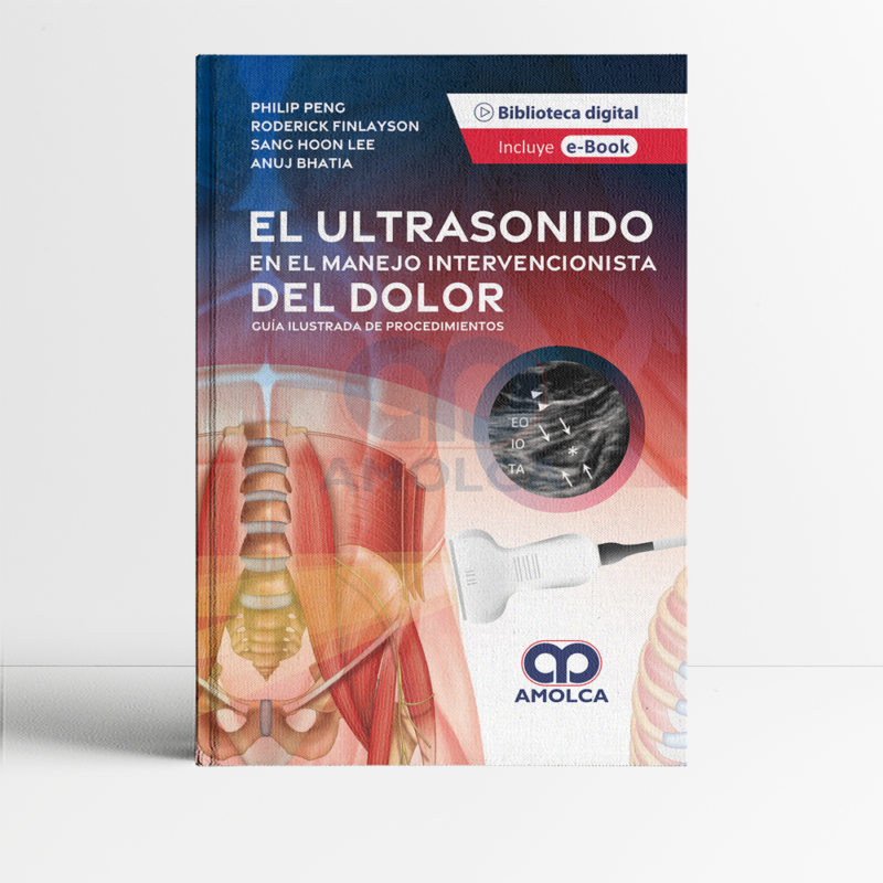 Libro El Ultrasonido En El Manejo Intervencionista Del Dolor 1era