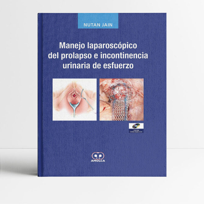 Manejo Laparoscópico del Prolapso e Incontinencia Urinaria de Esfuerzo - Jain