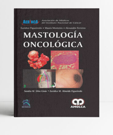Mastología Oncológica - Silva
