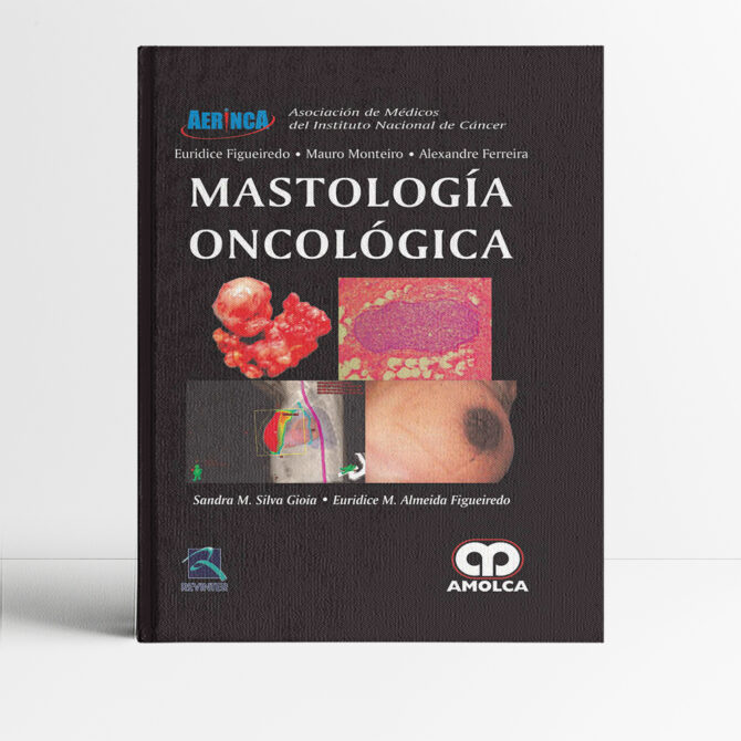 Mastología Oncológica - Silva