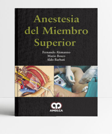 Anestesia del miembro superior - Alemanno