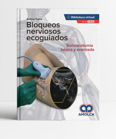 Bloqueos nerviosos ecoguiados Sonoanatomía básica y avanzada 1era edición - Tognu