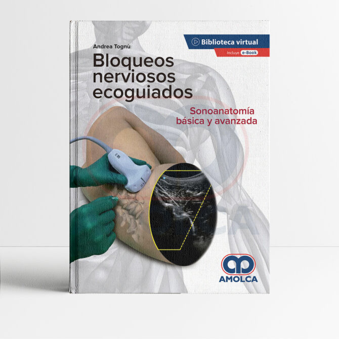 Bloqueos nerviosos ecoguiados Sonoanatomía básica y avanzada 1era edición - Tognu