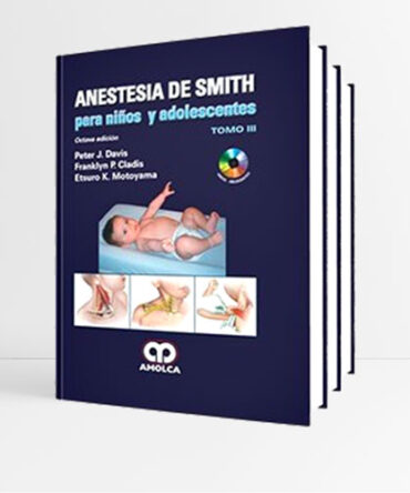 Anestesia de Smith para Niños y Adolescentes