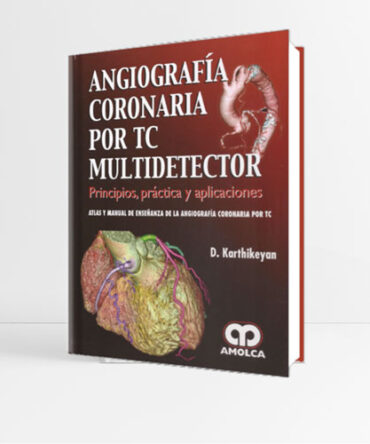 Angiografía Coronaria por TC Multidetector 1era edición