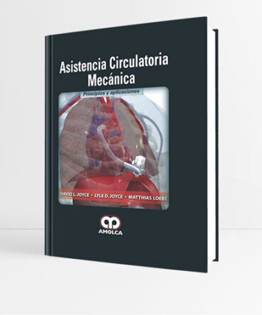 Asistencia Circulatoria Mecánica 1era edición