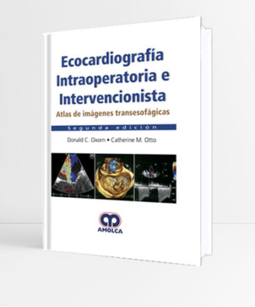 Ecocardiografía Intraoperatoria e Intervencionista