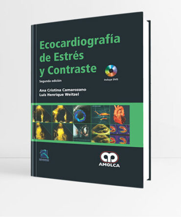 Ecocardiografía de Estrés y Contraste 2a edición