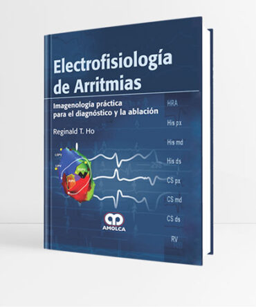 Electrofisiología de Arritmias 1era edición