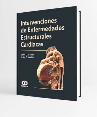 Intervenciones de Enfermedades Estructurales Cardiacas 1era edición