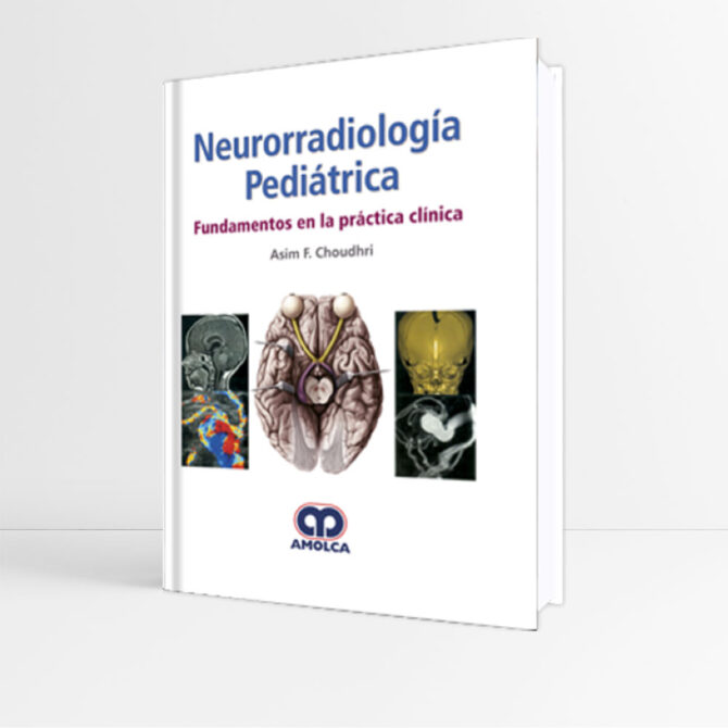 Neurorradiología Pediátrica