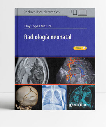 Radiologia neonatal