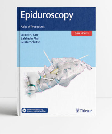 Epiduroscopy Atlas of Procedures