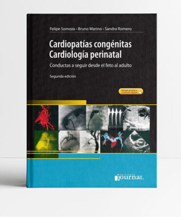 Cardiopatías congénitas Cardiología perinatal