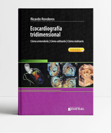 Ecocardiografía Tridimensional 1era edición