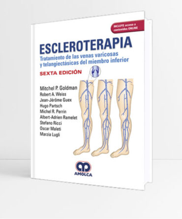Escleroterapia 6a edición