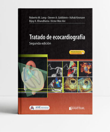Tratado de ecocardiografia 2a edición