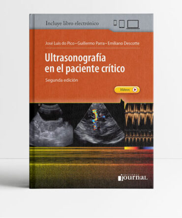 Ultrasonografía en el paciente crítico
