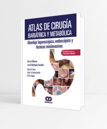 Atlas de Cirugía Bariátrica y Metabólica - Palermo