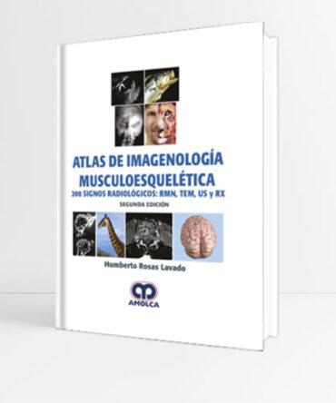 Atlas de Imagenología Musculoesquelética 2e - Rosas