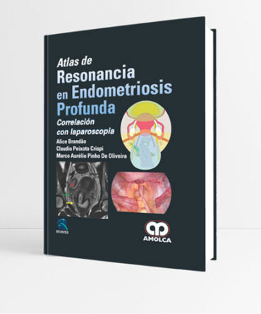 Atlas de Resonancia en Endometriosis Profunda - Brandao