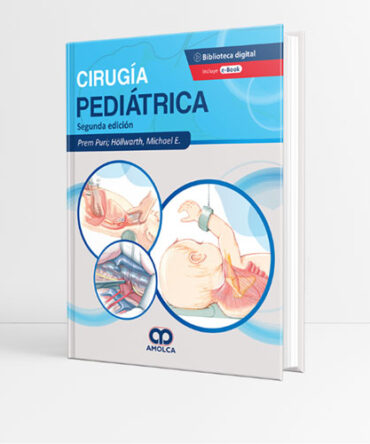 Cirugía Pediátrica 2a edición - Puri