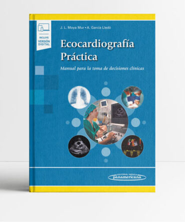 Ecocardiografía Práctica