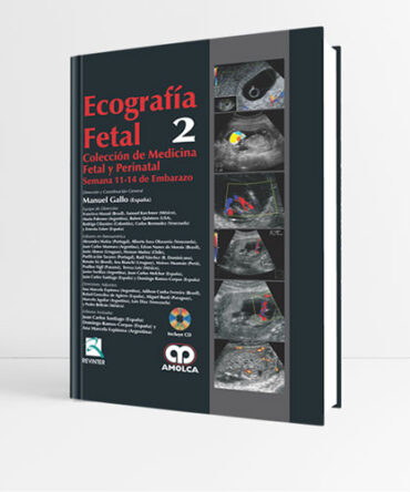 Ecografía Fetal Semana 11-14 de Embarazo Volumen 2 - Gallo