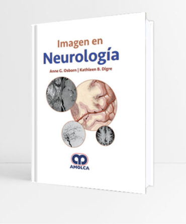 Imagen en Neurología - Osborn