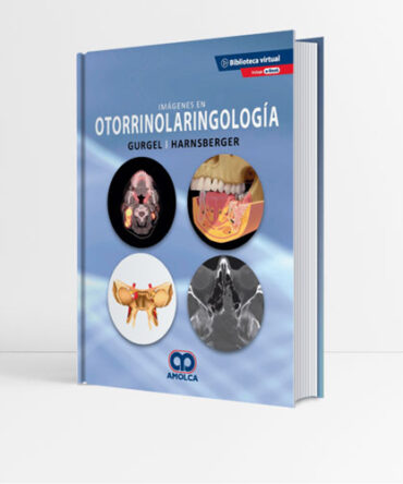 Imágenes en Otorrinolaringología - Gurgel