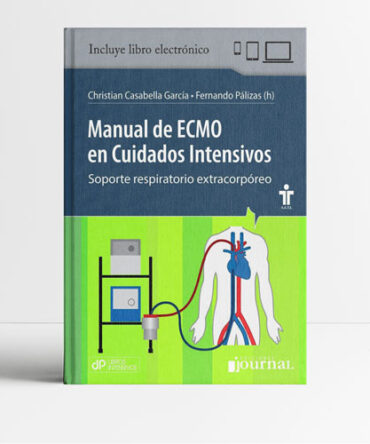 Manual de ECMO en Cuidados Intensivos