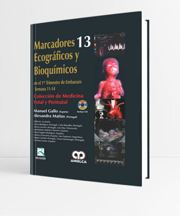 Marcadores Ecográficos y Bioquímicos en el 1er Trimestre de Embarazo Semana 11-14 Volumen 13 - Gallo