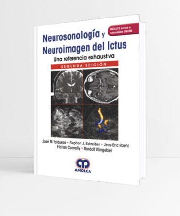 Neurosonología y Neuroimagen del Ictus una Referencia Exhaustiva 2e - Valdueza