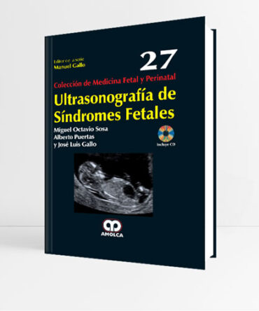 Ultrasonografía de Síndromes Fetales Volumen 27 - Sosa