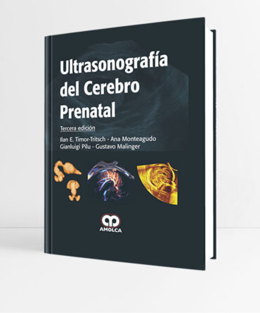 Ultrasonografía del Cerebro Prenatal 3e - Timor