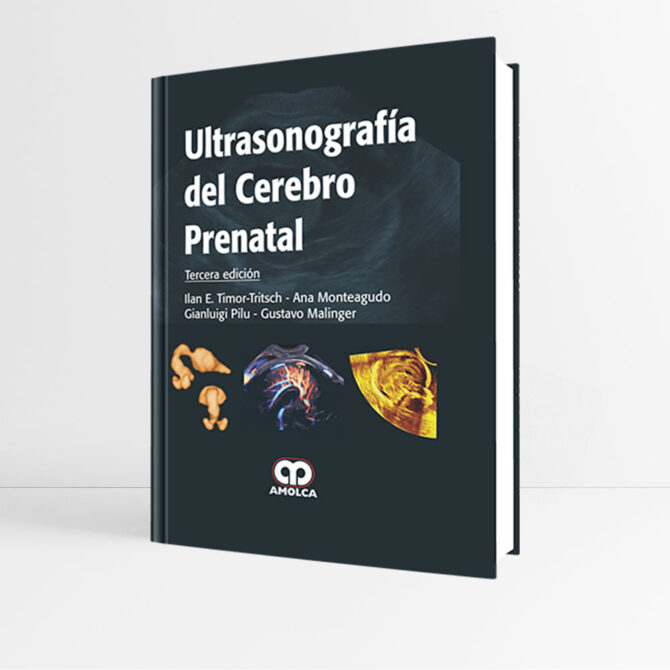 Ultrasonografía del Cerebro Prenatal 3e - Timor