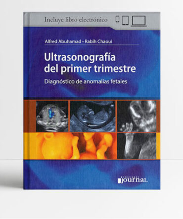Ultrasonografía del primer trimestre 1era edición - Abuhamad