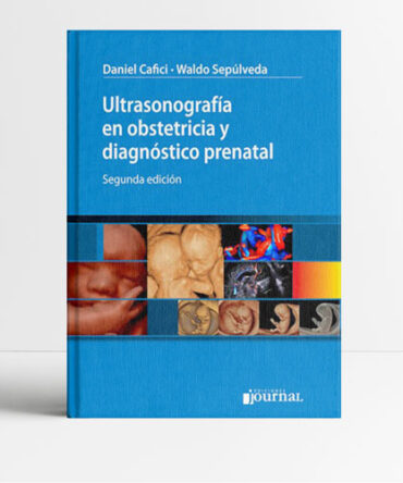 Ultrasonografía en obstetricia y diagnóstico prenatal 2a edición - Cafici