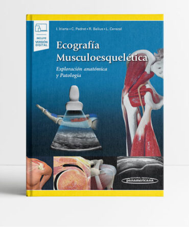 Ecografía Musculoesquelética Exploración anatómica y Patología - Iriarte