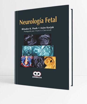 Neurologia Fetal - Pooh