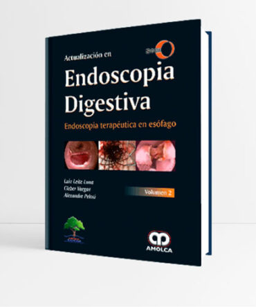 Actualización en Endoscopia Digestiva Vol. 2 Endoscopia Terapéutica en Esófago - Leite