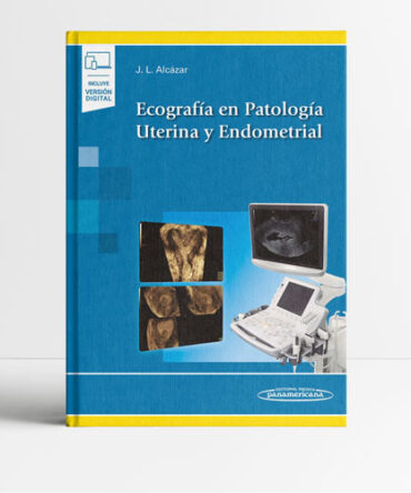 Ecografía en Patología Uterina y Endometrial - Alcazar