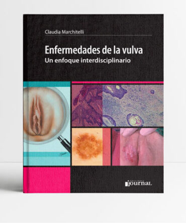 Enfermedades de la vulva 1era edición - Marchitelli