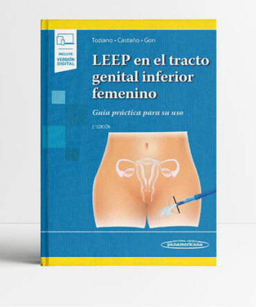 LEEP en el tracto genital inferior femenino 2a edición - Toziano