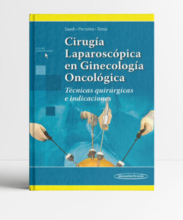 Cirugía Laparoscópica en Ginecología Oncológica - Saadi