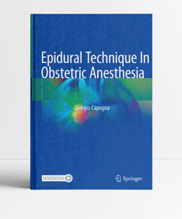 Epidural Technique In Obstetric Anesthesia - Capogna