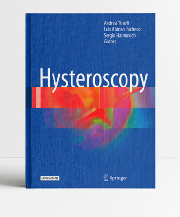 Hysteroscopy - Tinelli