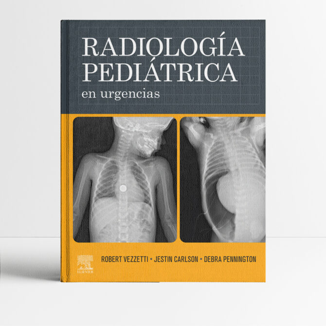 Radiología pediátrica en urgencias - Vezzetti