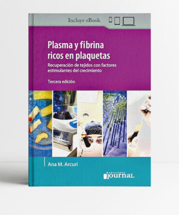 Plasma y fibrina ricos en plaquetas 3era edicion - Arcuri
