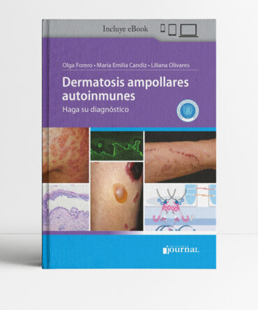Portada de Dermatosis ampollares autoinmunes - Forero